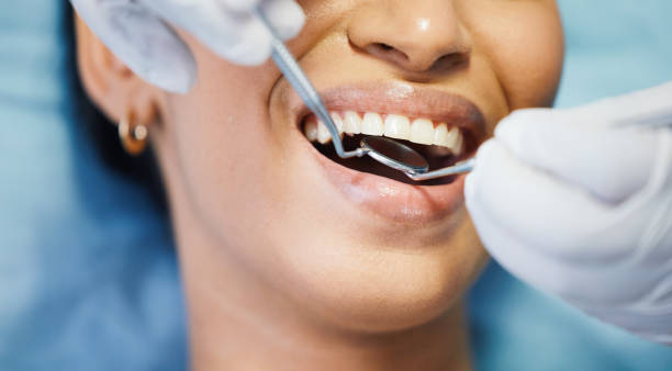 Best Emergency Tooth Extraction in Brices Creek, NC